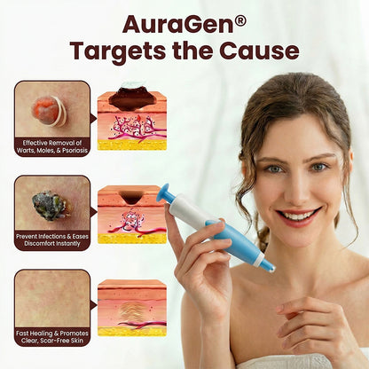 AuraGen® Double-ended wart removal pen