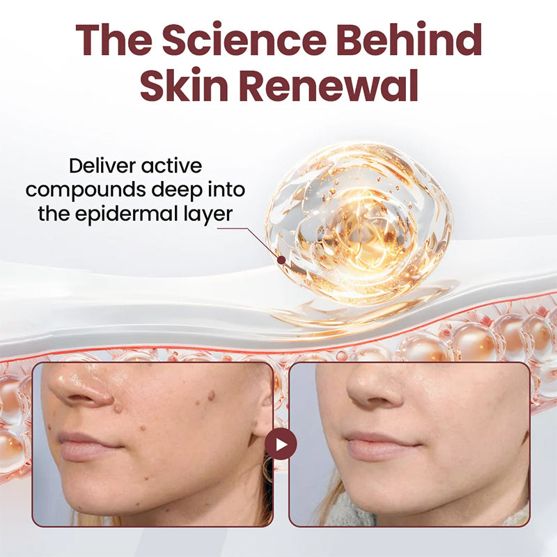 AuraGen® Double-ended wart removal pen