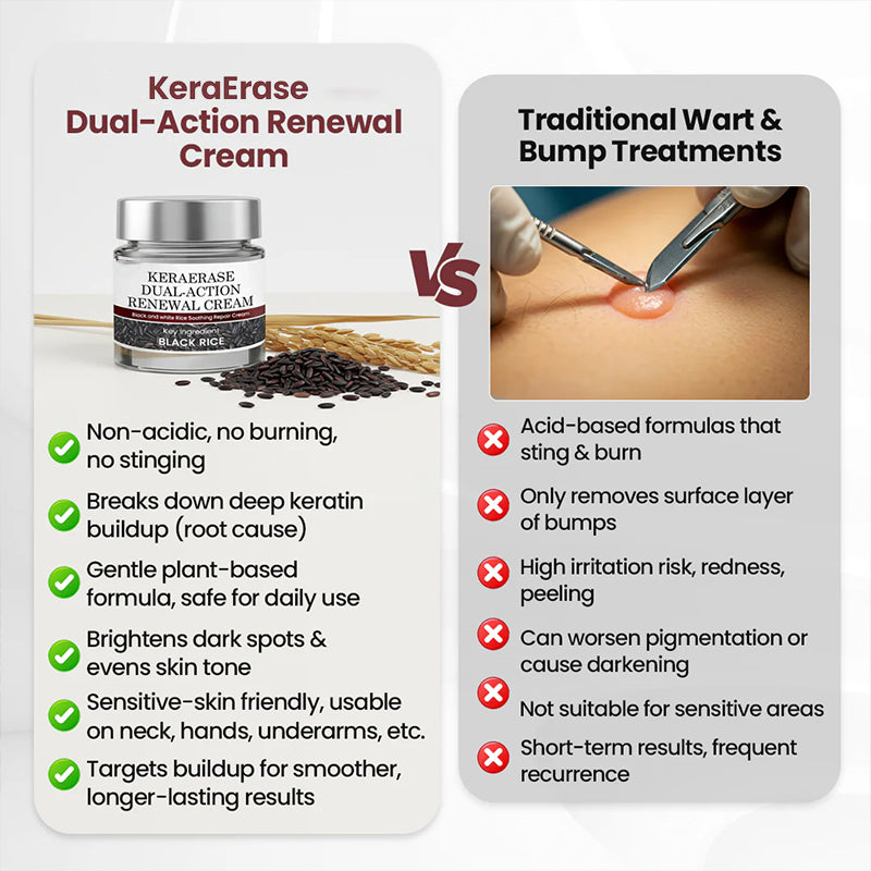 KeraErase Dual-Action Renewal Cream