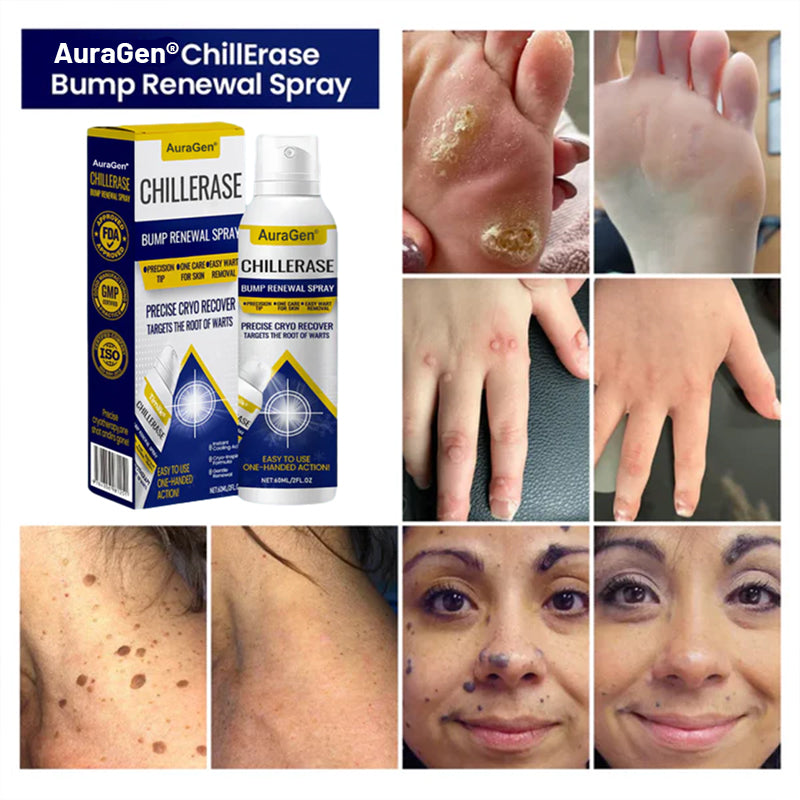 AuraGen® ChillErase Bump Renewal Spray