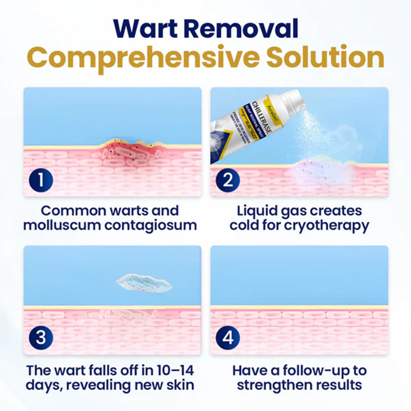 AuraGen® ChillErase Bump Renewal Spray