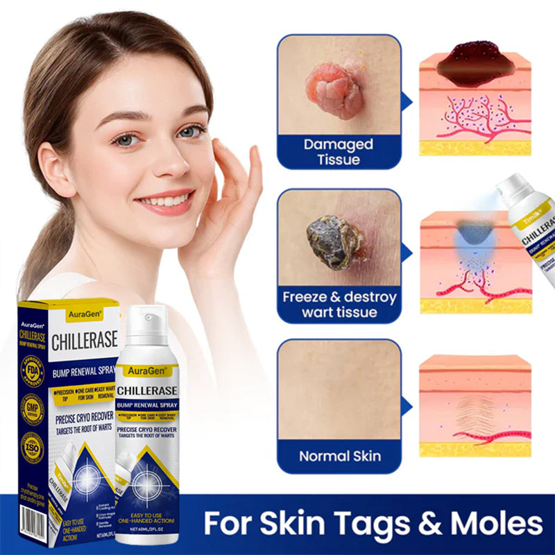 AuraGen® ChillErase Bump Renewal Spray